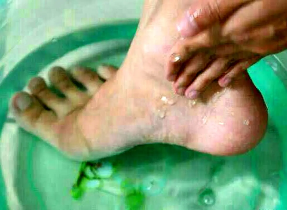 این روش ساده و ارزون پاهاتو از واریس نجات می‌ده | راز آب سرد!