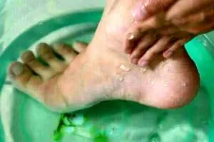 این روش ساده و ارزون پاهاتو از واریس نجات می‌ده | راز آب سرد!