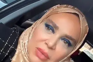 سوختن فسفری بهاره رهنما| داغداری بهاره خانم از شک‌هایش